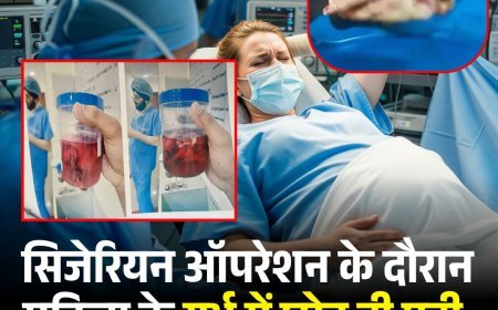 सिजेरियन ऑपरेशन के दौरान महिला के गर्भ में छोड़ दी पट्टी, आंत काटकर पट्टी निकाली गई