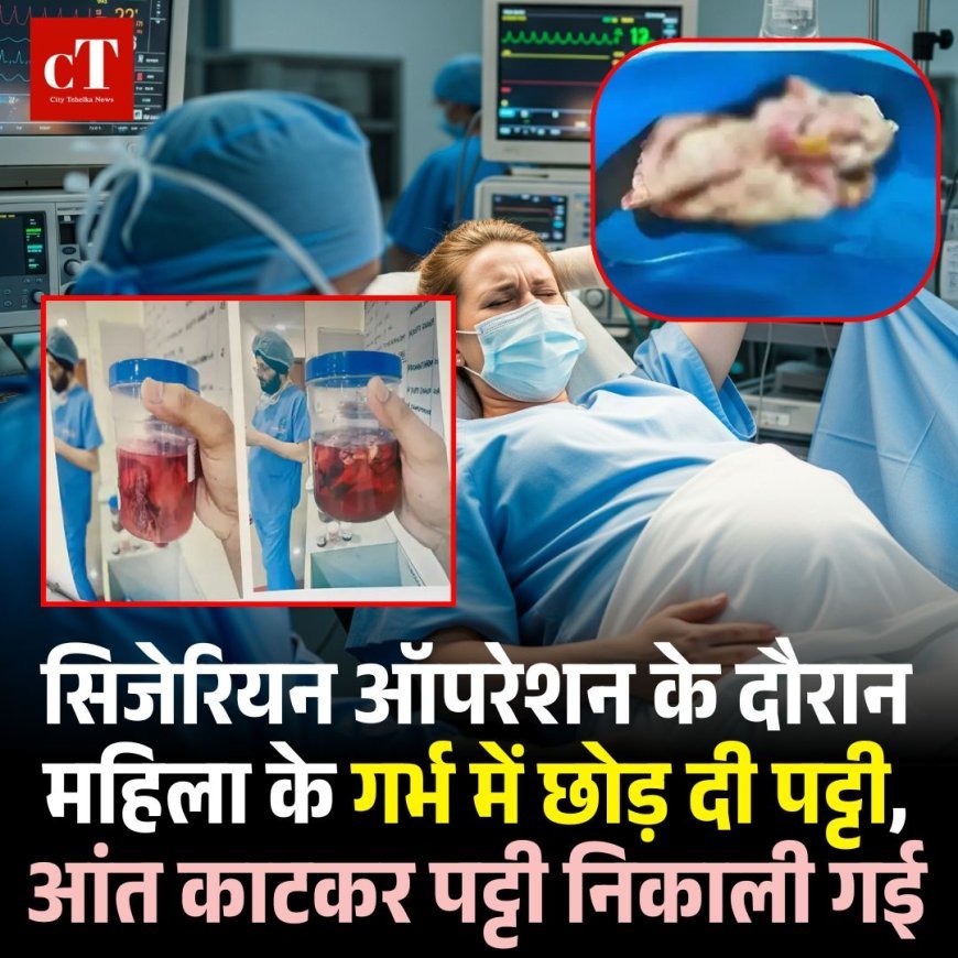 सिजेरियन ऑपरेशन के दौरान महिला के गर्भ में छोड़ दी पट्टी, आंत काटकर पट्टी निकाली गई