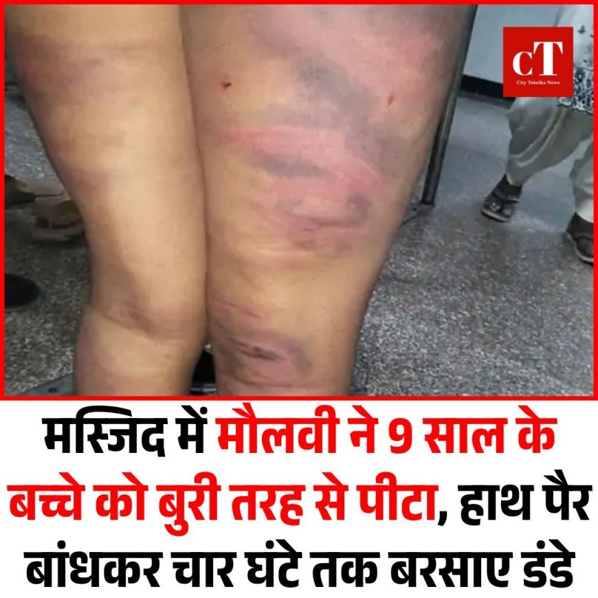 मस्जिद में मौलवी ने 9 साल के को बुरी तरह से पीटा, हाथ पैर बांधकर चार घंटे तक बरसाए डंडे